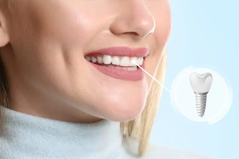 Local SEO for Dentists: What Should Be on Every City Page? dental guide image