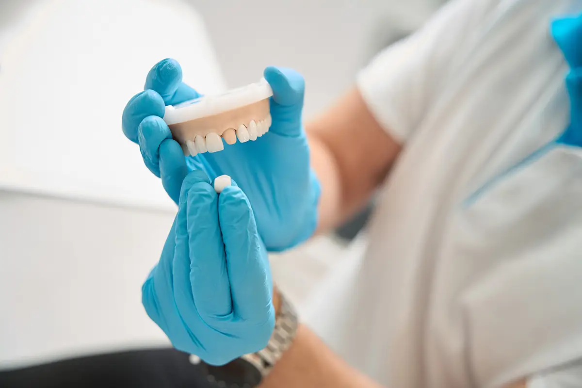 Smile Society Dental Studio before and after result